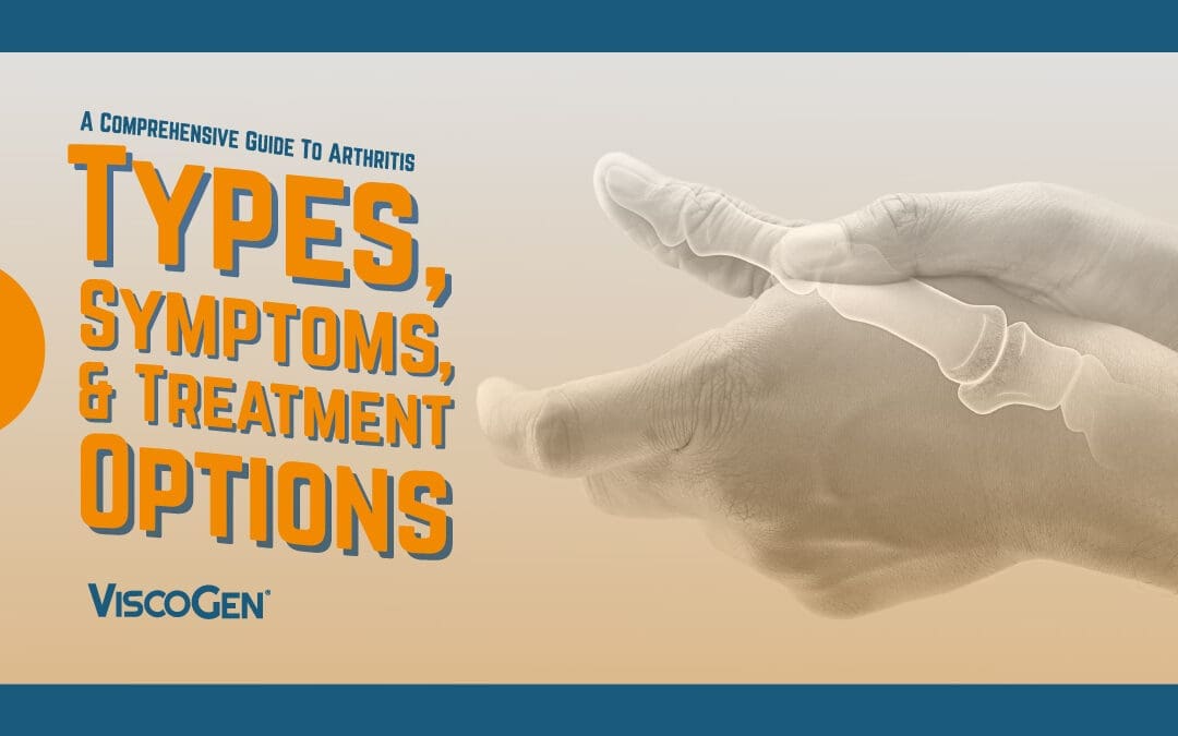 Your Guide to Arthritis: Symptoms and Treatment