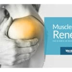 Muscle and Joint Renewal: The Science of Regenerative Medicine
