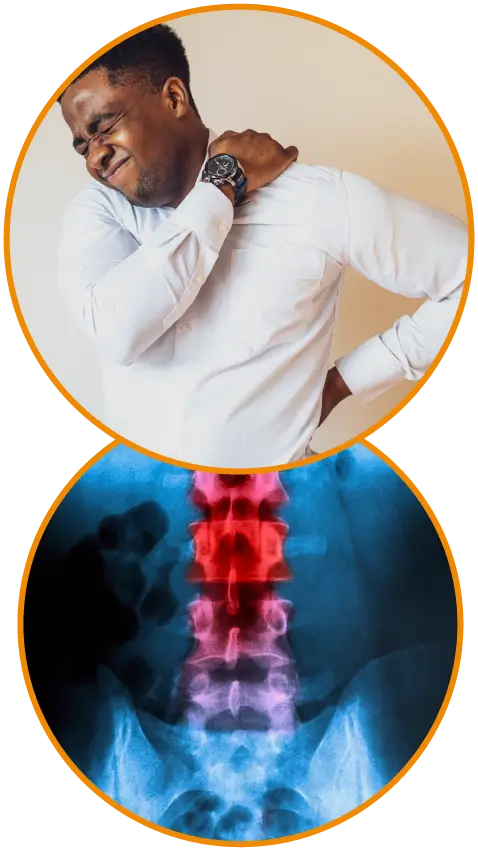 Spinal Decompression Spinal Decompression